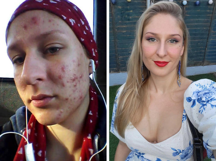 a9e3535305b789623ab49abfcd 13 Before-and-After Photos That Tell a Whole Story / Bright Side