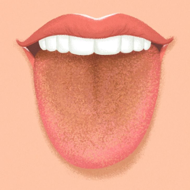 9 Things Your Tongue Is Trying to Tell You About Your Health