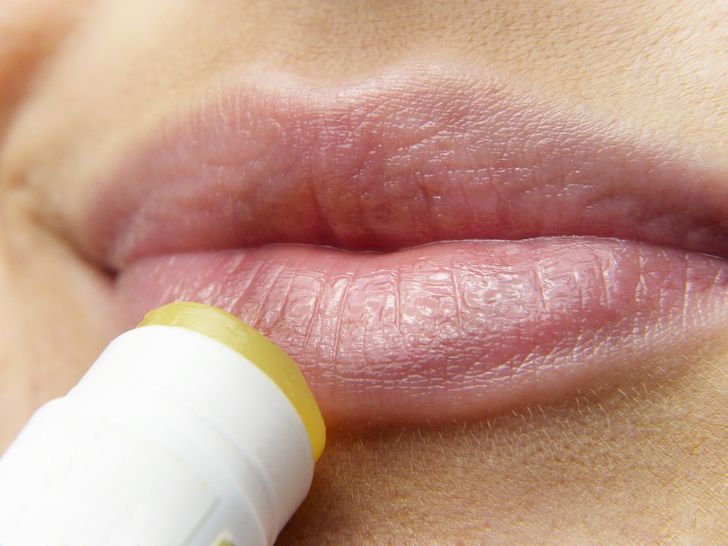 5 Things That Can Keep You From Getting an Unpleasant Cold Sore on Your Lips
