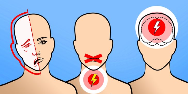 6 Warning Signs That Show a Stroke Is Coming, and It’s Really Important to Know Them