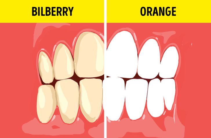 สีของฟันเกิดขึ้นจากอาหารหรือไม่?