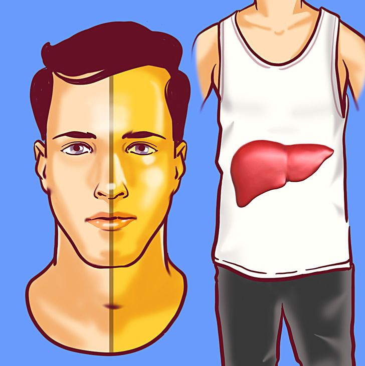 8 Unexpected Signs of Liver Disease That Show You Need to Visit a Doctor ASAP