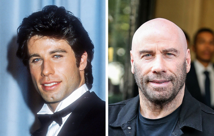 What 15+ Famous Men Looked Like Before They Decided to Go Bald
