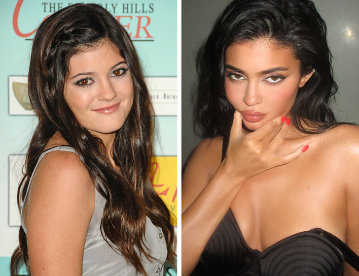 Kylie Jenner Confirms She Got Plastic Surgery Done, Expresses Regret