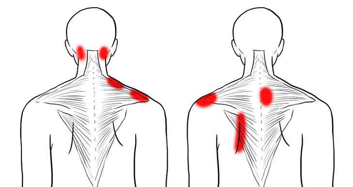 How to Relieve Tension in Neck and Shoulders From Anxiety