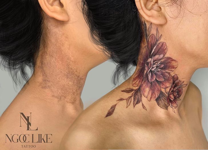 Tattoo artist sees bump in desire to erase hateful skin art