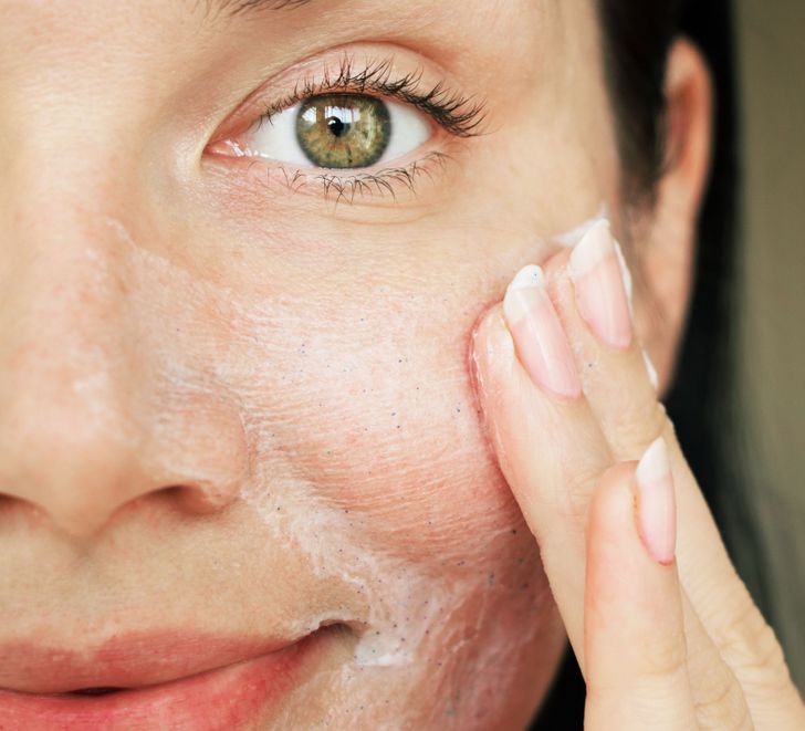 7 Things That May Cause Dark Spots