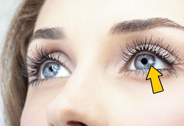 12 Things Your Eyes Can Tell About Your Health