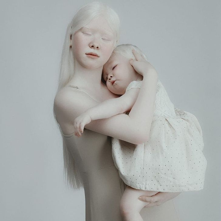 Albino Sisters Born 12 Years Apart Excite the Internet With Their Photos