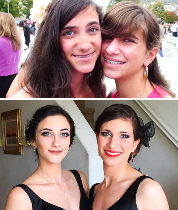 23 Before and After Photos That Show Drastic Changes