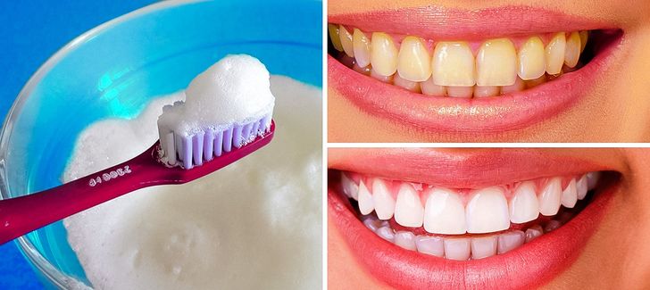 The 10 Best Ways to Naturally Whiten Yellow Teeth at Home