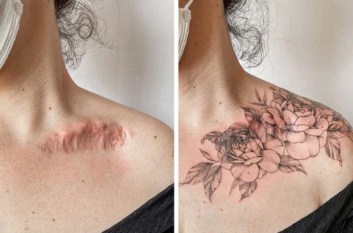 16 People Who Transformed Their Scars Into Pieces of Art