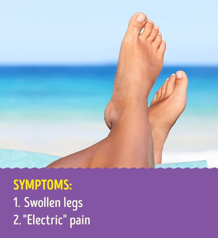 9 Leg Health Problems That Can Signal Serious Illnesses