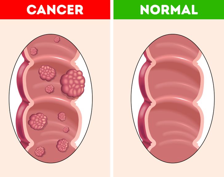 What Will Happen to Your Body If You Start Eating 3 Dates Every Day for a Week