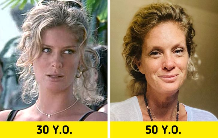 11 Celebrities Who Shunned Cosmetic Surgery and Embraced Their Natural Look