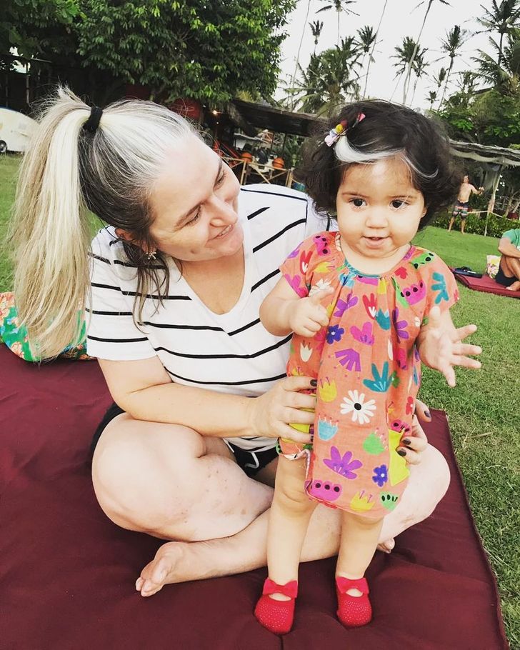 This Baby Girl Who Was Born With Gray Hair Is Proof That Our Flaws Make Us More Beautiful