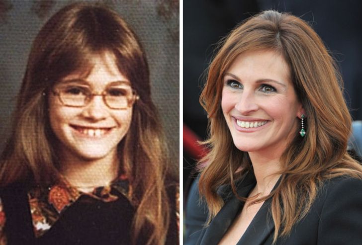 15 Celebrities Who Blossomed After Puberty