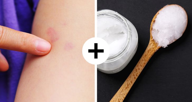 10+ Quick First Aid Tips That Can Save Your Day