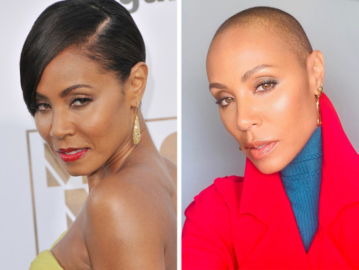 10 Celebrities Revealed Why They Shaved Their Heads, and We Couldn’t Be More Proud of Them