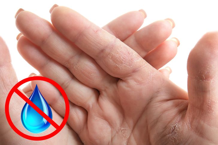 7 Things Your Hands Can Tell About Your Health