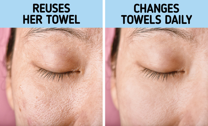 Why We Shouldn’t Use the Same Towel More Than 2 Days in a Row