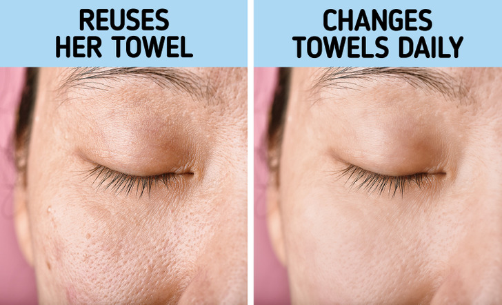 Why You Should Never Dry Your Face With a Hand Towel