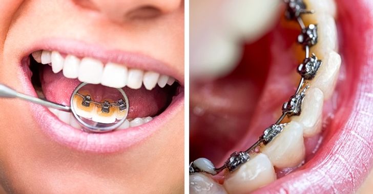 8 Major Mistakes We Make When Taking Care of Our Teeth