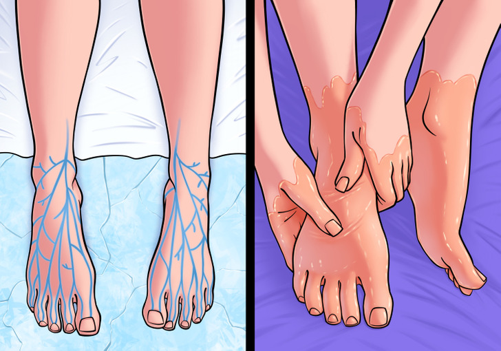 How To Manage Cold Feet At Home