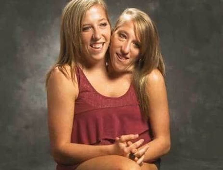 And brittany siamese abby twins 20 Facts