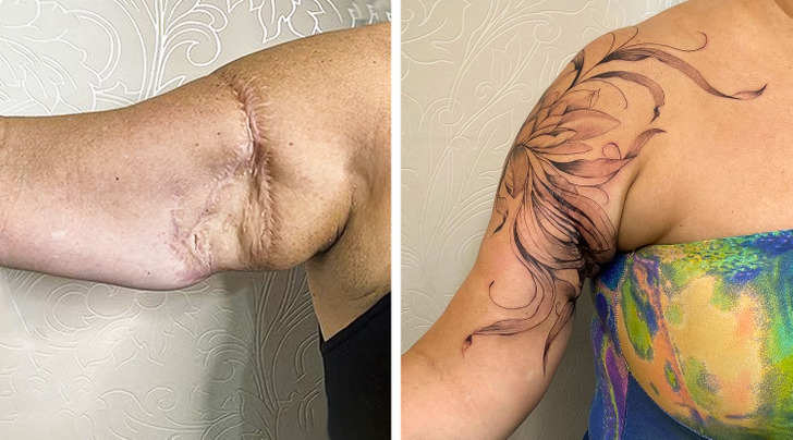 Artist Tattoos Scars So People Can Show Traits They Wanted to Hide  Bright  Side