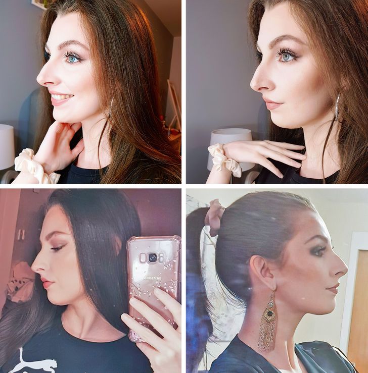 20+ Girls Who Finally Embraced Their Non-Standard Noses and Are Really Happy Now