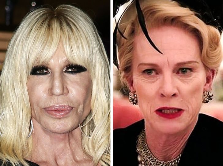 Donatella Versace  Celebrity plastic surgery, Beauty hacks, Plastic  surgery gone wrong