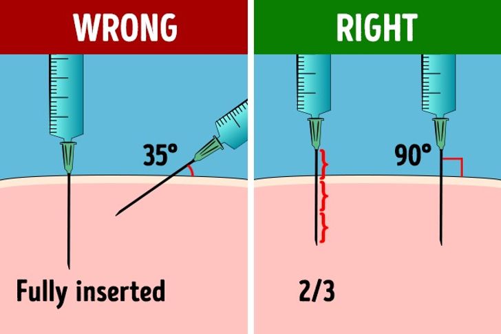 How to Perform an Injection If You’ve Never Done It Before