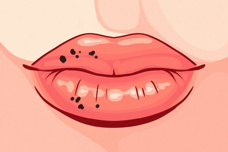 8 Things Your Lips Are Trying to Tell You About Your Health