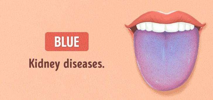 13 Things Your Tongue Is Trying to Tell You About Your Health