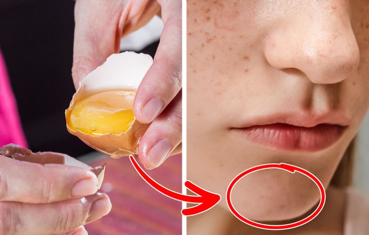 9 Simple Ingredients to Get Rid of Facial Hair at Home