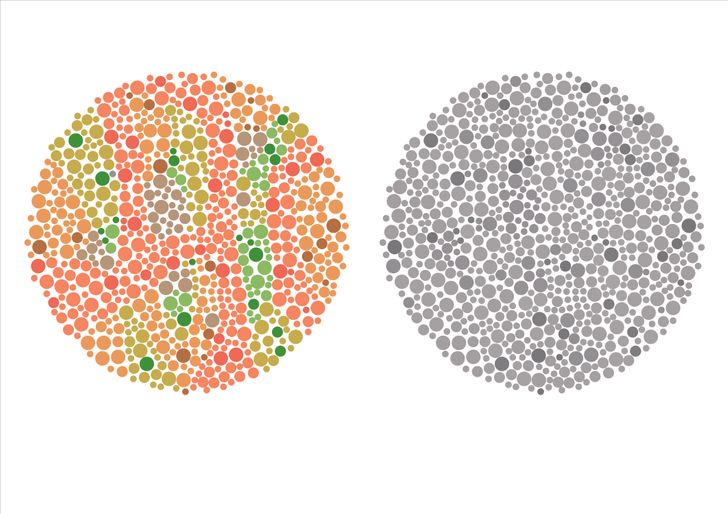 Vision Test: Check How Good Your Eyes Are