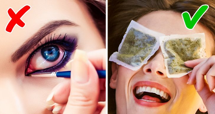 14 Effective Ways to Treat and Prevent Eye Infections Naturally