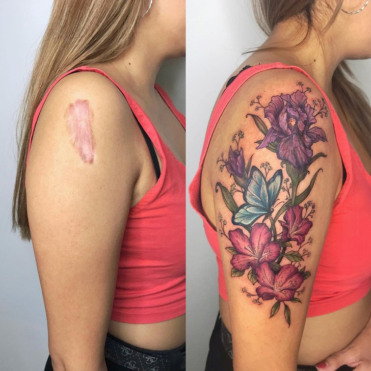 Scar Cover Up Tattoos | Hide Scar with tattoo in Malaysia