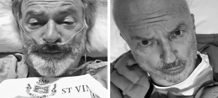 A side by side picture of Sam Neill on his cancer treatment.