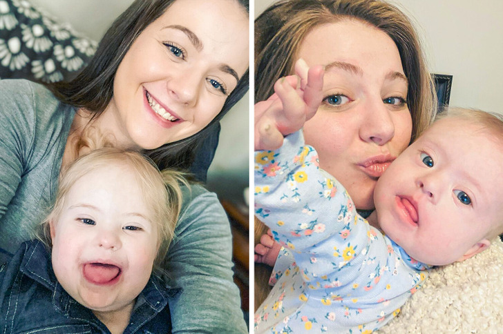 Mosaic Down Syndrome