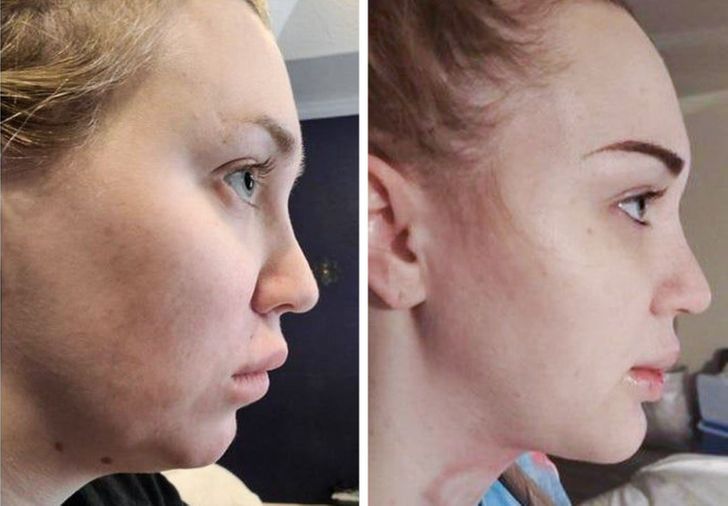 19 People Who Got a Complete Makeover, and Their Only Regret Was Not Doing It Sooner