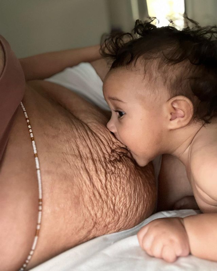 Mom shares postpartum photo to show 'realistic' side of giving