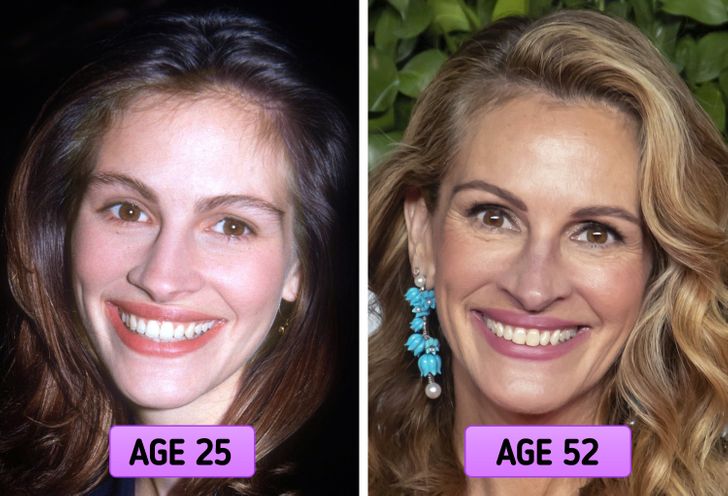 15 Celebrity Plastic Surgery Disasters -   Celebrity plastic surgery,  Bad celebrity plastic surgery, Celebrity surgery