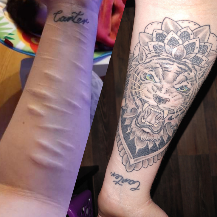 15 Powerful Tattoos That Make Scars Come Alive