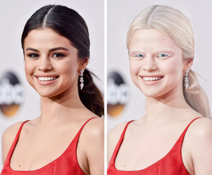 What 15 Celebs Would Look Like If They Were Albinos