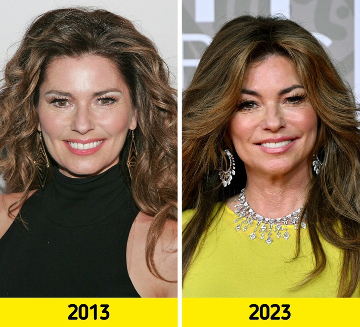 «What Did She Do to Her Face?» — Shania Twain’s New Look Shocks People