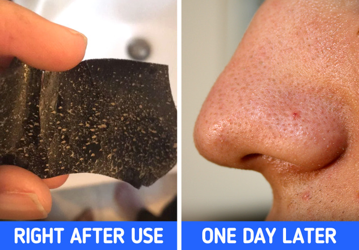 pore strips before and after