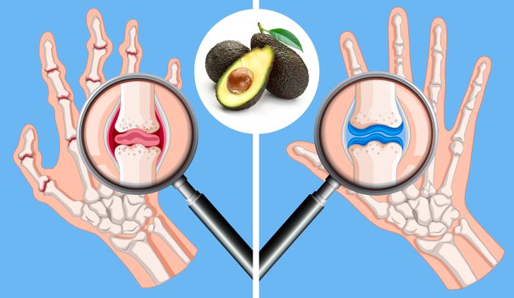What Can Happen to Your Body If You Start Eating an Avocado a Day for 30 Days