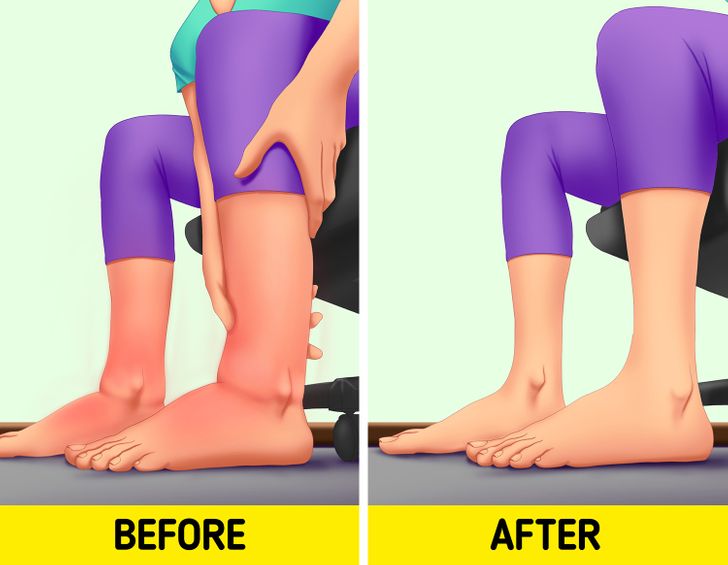 10 Tips for Swollen Legs Your Body Will Thank You For Bright Side